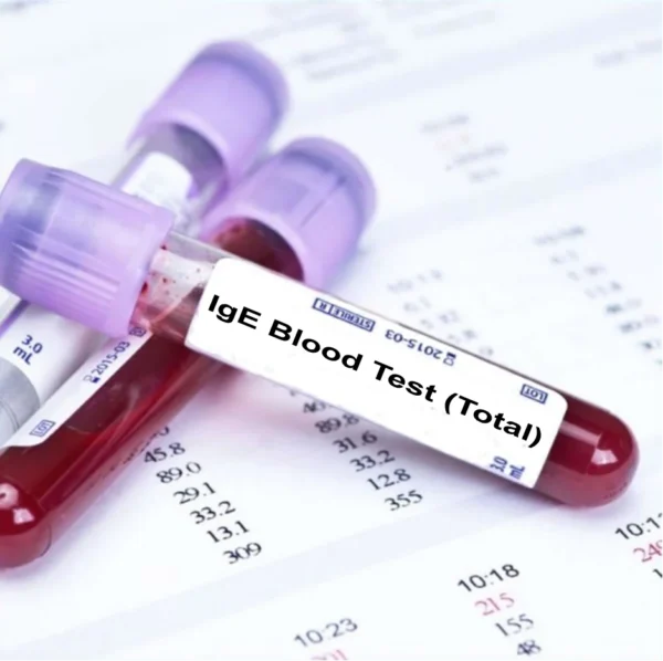 IgE Total antibody