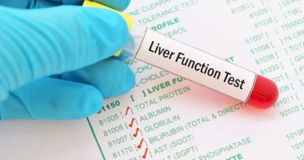 LFT (Liver Function Test)