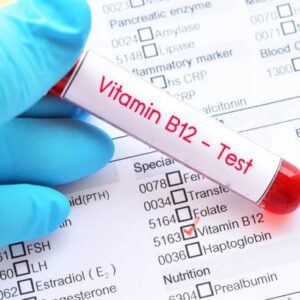 Vitamin B12 Test (cyanocobalamin)
