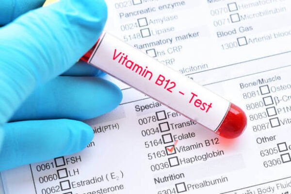 Vitamin B12 Test (cyanocobalamin)