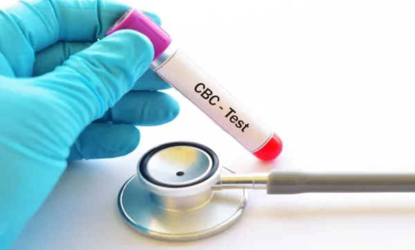 CBC (Complete Blood Count)