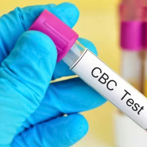 CBC (Complete Blood Count)
