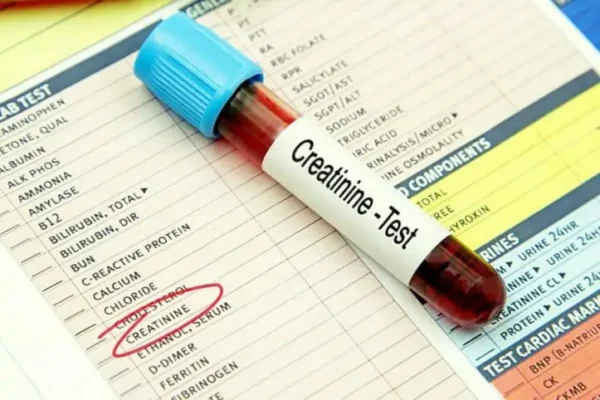 Creatinine Test