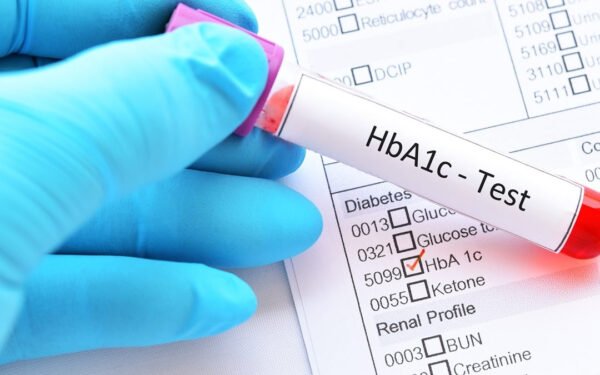 HbA1c (Glycated Hemoglobin Test)