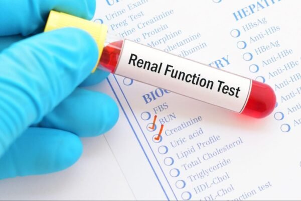 KFT (Kidney Function Test)